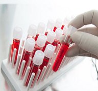 Hematology